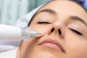 Best Actinic Keratoses Removal 3 Actinic keratoses Frome solutions - book in today!
